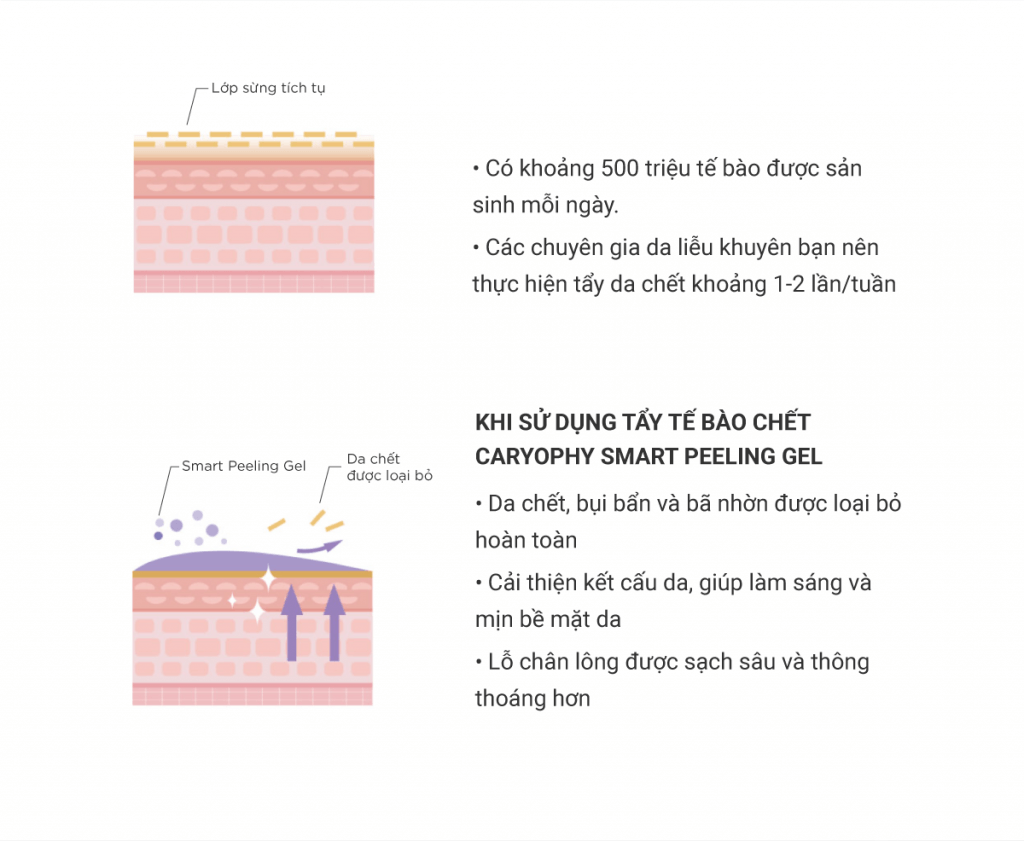 INFOGRAPHIC-Peeling-Gel_06-1024x841